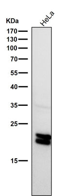 Anti-Caveolin-1 CAV1 Rabbit Monoclonal Antibody Boster Bio