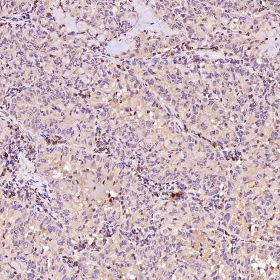 Anti-Bax Rabbit Monoclonal Antibody Boster Bio