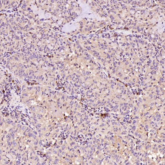Anti-Bax Rabbit Monoclonal Antibody Boster Bio