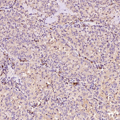 Anti-Bax Rabbit Monoclonal Antibody Boster Bio