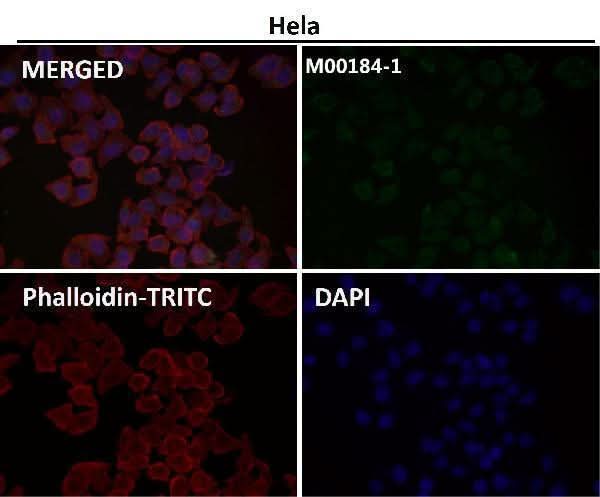 Anti-NCAM NCAM1 Rabbit Monoclonal Antibody Boster Bio