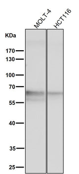 Anti-TRAF6 Rabbit Monoclonal Antibody Boster Bio