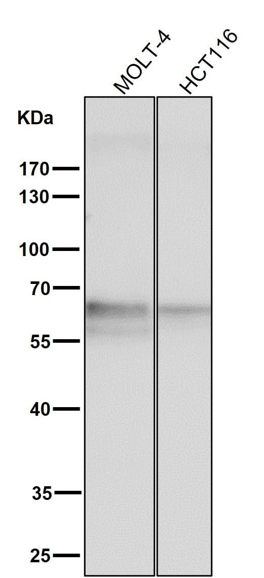 Anti-TRAF6 Rabbit Monoclonal Antibody Boster Bio