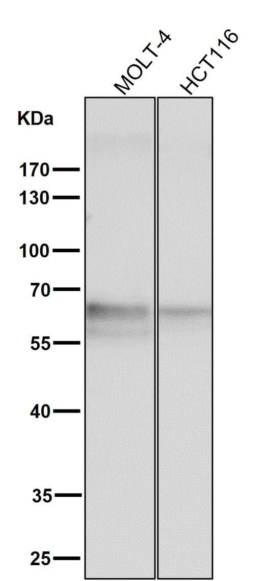 Anti-TRAF6 Rabbit Monoclonal Antibody Boster Bio