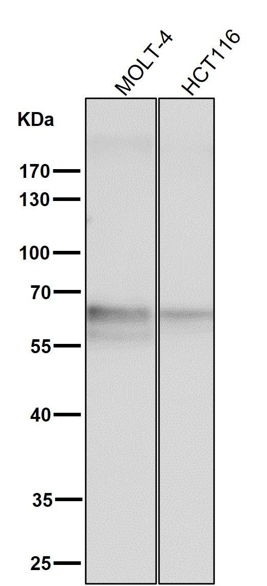 Anti-TRAF6 Rabbit Monoclonal Antibody Boster Bio