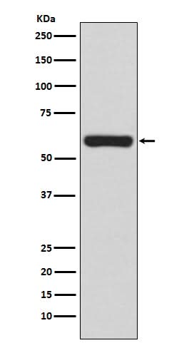 Anti-TRAF6 Rabbit Monoclonal Antibody Boster Bio