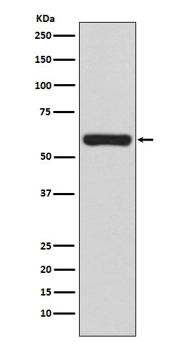 Anti-TRAF6 Rabbit Monoclonal Antibody Boster Bio