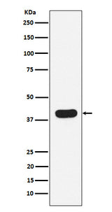 Anti-HLA B7 Rabbit Monoclonal Antibody Boster Bio