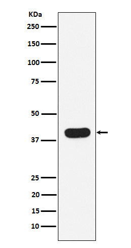 Anti-HLA B7 Rabbit Monoclonal Antibody Boster Bio