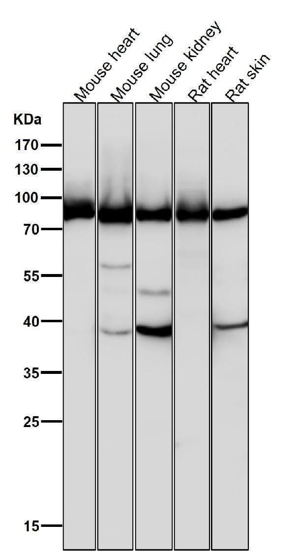 Anti-Argonaute 2 AGO2 Rabbit Monoclonal Antibody Boster Bio