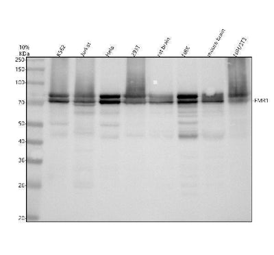 Anti-FMRP FMR1 Rabbit Monoclonal Antibody Boster Bio