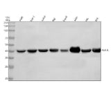 Anti-MHC class 1 HLA-A Rabbit Monoclonal Antibody Boster Bio