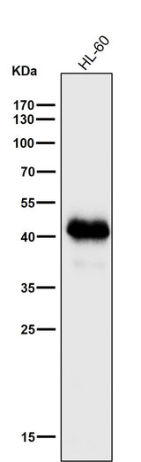 Anti-MHC class I HLA-A Rabbit Monoclonal Antibody Boster Bio
