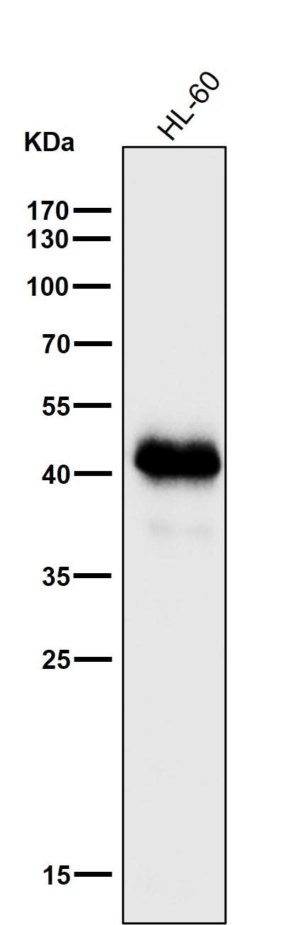 Anti-MHC class I HLA-A Rabbit Monoclonal Antibody Boster Bio