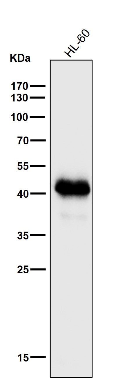 Anti-MHC class I HLA-A Rabbit Monoclonal Antibody Boster Bio