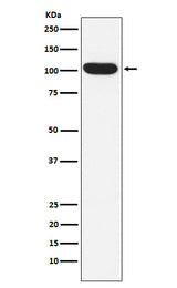 Anti-ITCH Rabbit Monoclonal Antibody Boster Bio