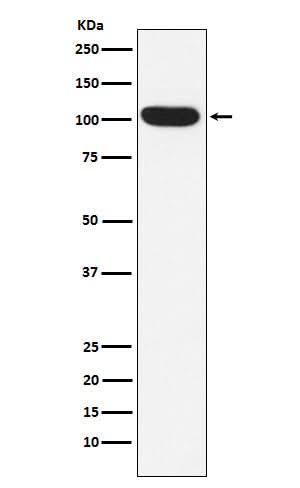 Anti-ITCH Rabbit Monoclonal Antibody Boster Bio