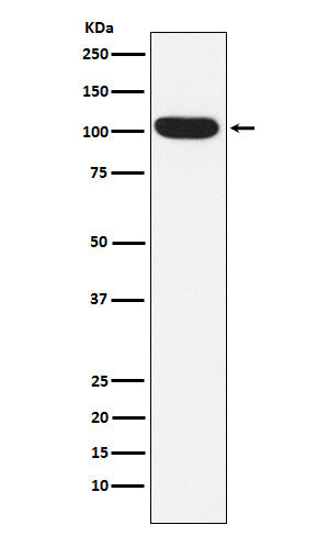 Anti-ITCH Rabbit Monoclonal Antibody Boster Bio