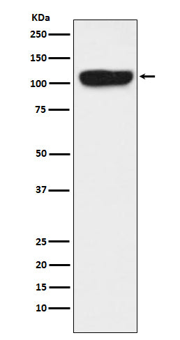 Anti-ITCH Monoclonal Antibody Boster Bio