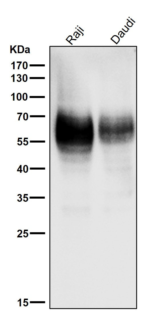 Anti-CD80/B7 1 Rabbit Monoclonal Antibody Boster Bio