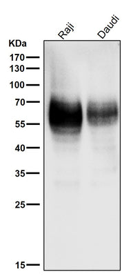 Anti-CD80/B7 1 Rabbit Monoclonal Antibody Boster Bio