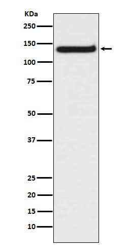 Anti-TLR9 Rabbit Monoclonal Antibody Boster Bio