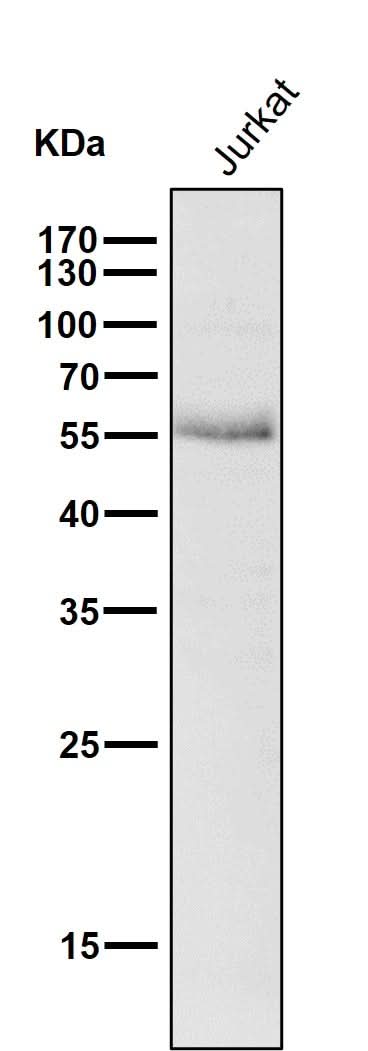 Anti-Wilms Tumor Protein WT1 Rabbit Monoclonal Antibody Boster Bio