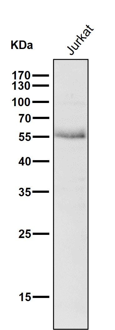 Anti-Wilms Tumor Protein WT1 Rabbit Monoclonal Antibody Boster Bio