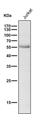 Anti-Wilms Tumor Protein WT1 Rabbit Monoclonal Antibody Boster Bio