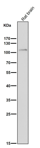 Anti-FGFR3 Rabbit Monoclonal Antibody Boster Bio