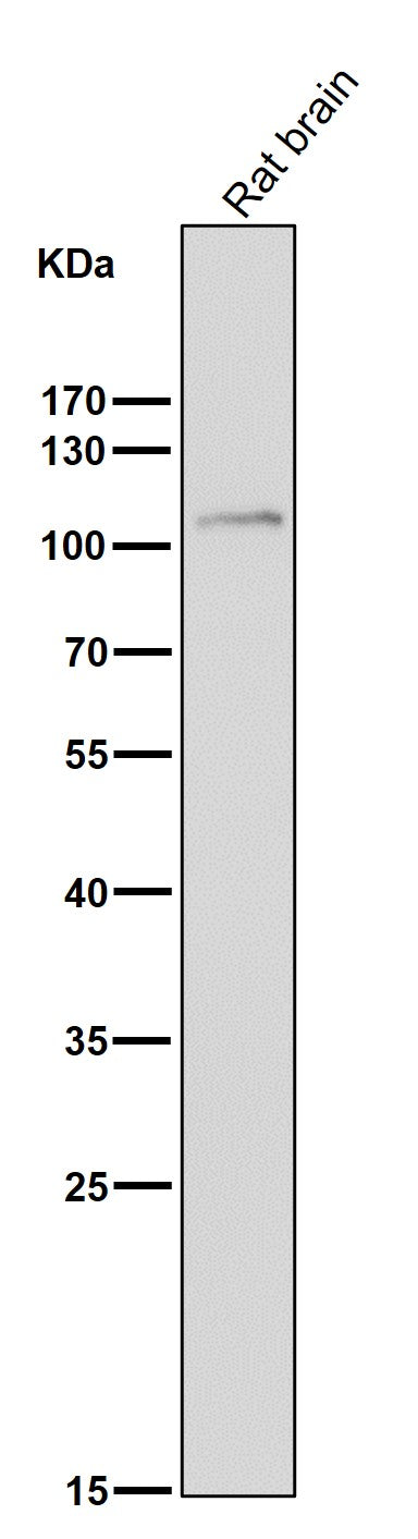 Anti-FGFR3 Rabbit Monoclonal Antibody Boster Bio