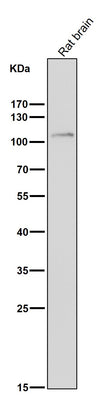 Anti-FGFR3 Rabbit Monoclonal Antibody Boster Bio