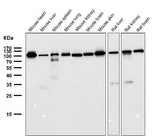 Anti-FGFR3 Rabbit Monoclonal Antibody Boster Bio