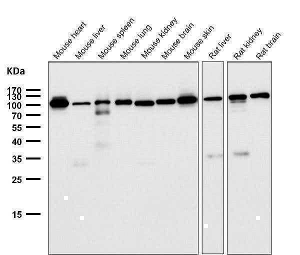 Anti-FGFR3 Rabbit Monoclonal Antibody Boster Bio