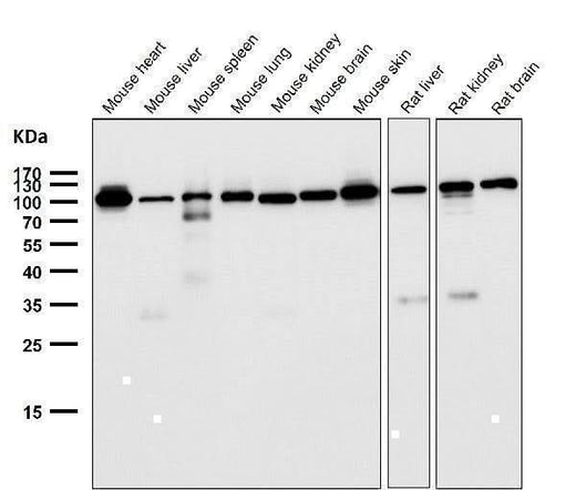 Anti-FGFR3 Rabbit Monoclonal Antibody Boster Bio