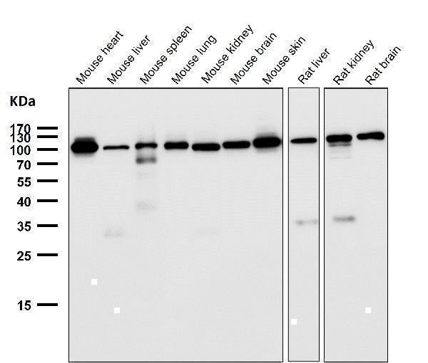 Anti-FGFR3 Rabbit Monoclonal Antibody Boster Bio