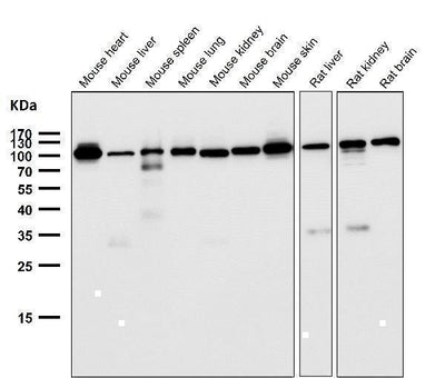 Anti-FGFR3 Rabbit Monoclonal Antibody Boster Bio
