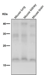 Anti-FGF1 Rabbit Monoclonal Antibody Boster Bio