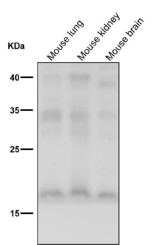 Anti-FGF1 Rabbit Monoclonal Antibody Boster Bio