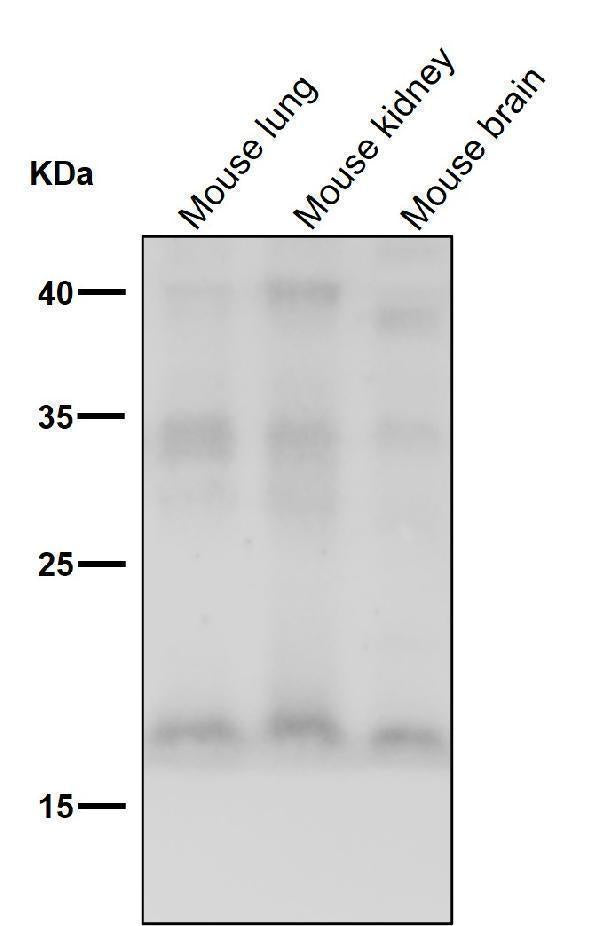 Anti-FGF1 Rabbit Monoclonal Antibody Boster Bio