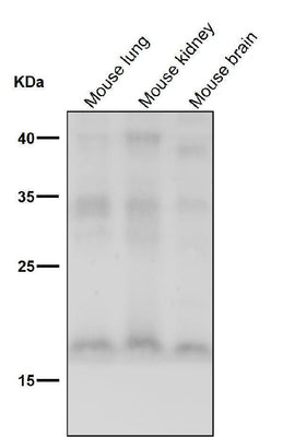 Anti-FGF1 Rabbit Monoclonal Antibody Boster Bio