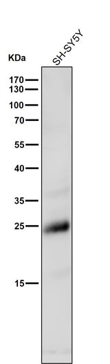 Anti-Rho RHOA Rabbit Monoclonal Antibody Boster Bio