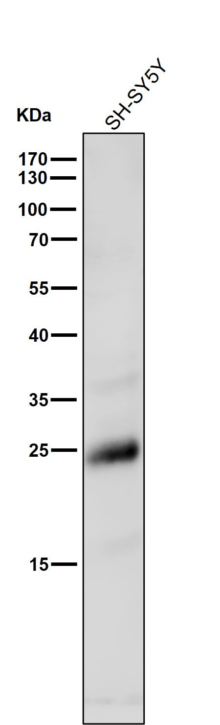 Anti-Rho RHOA Rabbit Monoclonal Antibody Boster Bio
