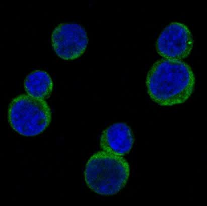 Anti-Rho A Rabbit Monoclonal Antibody Boster Bio