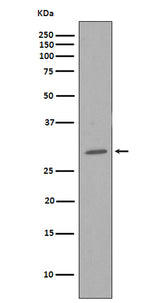 Anti-CDK1/Cdc2 Rabbit Monoclonal Antibody Boster Bio