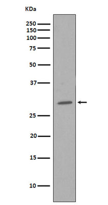 Anti-CDK1/Cdc2 Rabbit Monoclonal Antibody Boster Bio