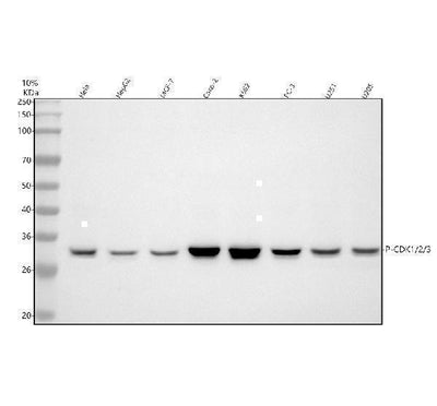 Anti-CDK1/Cdc2 Rabbit Monoclonal Antibody Boster Bio