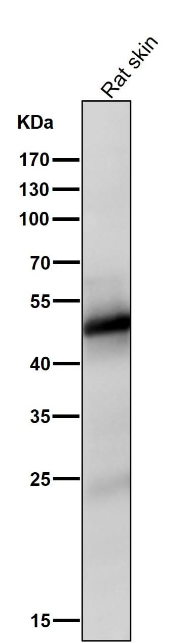 Anti-Vitamin D Receptor VDR Rabbit Monoclonal Antibody Boster Bio