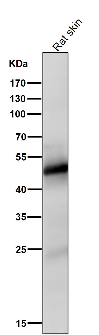 Anti-Vitamin D Receptor VDR Rabbit Monoclonal Antibody Boster Bio