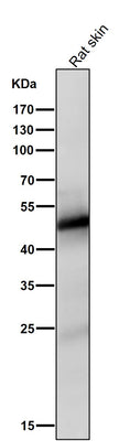 Anti-Vitamin D Receptor VDR Rabbit Monoclonal Antibody Boster Bio
